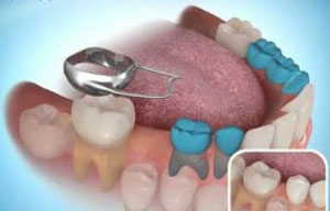 Best Dental Clinic in Madinaguda