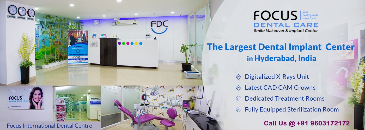 Best Dental Implants Clinic In Hyderabad India Top Dental Clinics In Madinaguda Gachibowli Focus Dental Care