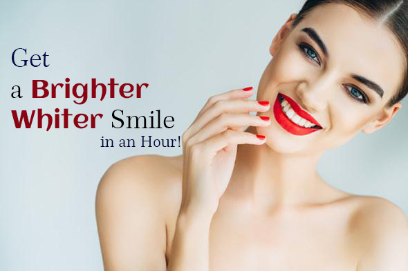 Teeth Whitening in Hyderabad | Focus Dental Care