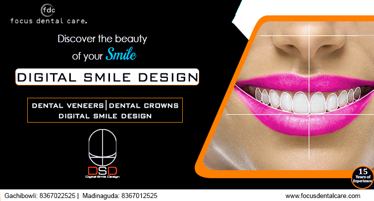 Digital-Smile-Design-in-Hyderabad