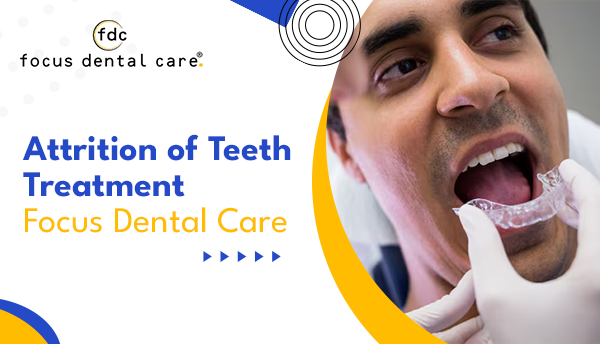 Attrition of Teeth Treatment | Focus Dental Care