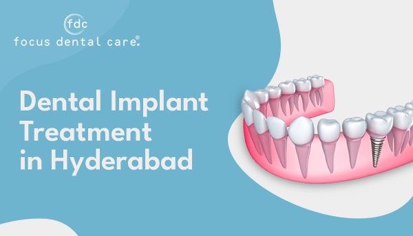 Dental Implant Treatment in Hyderabad | Focus Dental Care