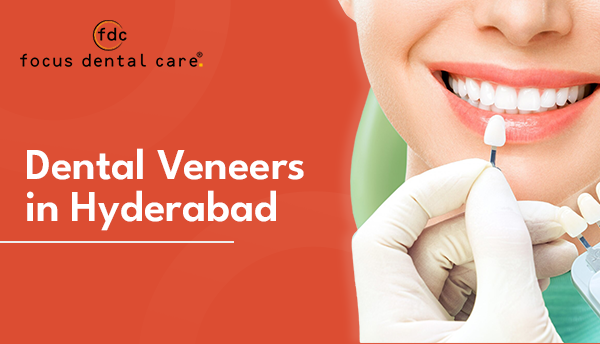 Dental Veneers in Hyderabad | Focus Dental Care